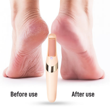 Rechargeable Electric Foot File Callus Remover Pedicure Machine